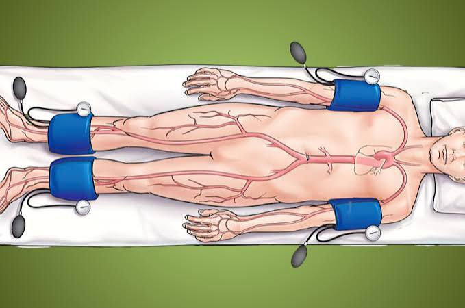 Ankle-brachial index (ABI) vascular ultrasound test being performed on a patient leg to assess blood flow