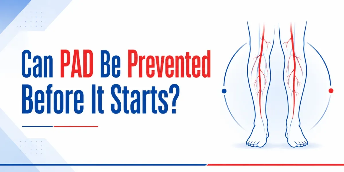Can PAD Be Prevented Before It Starts?